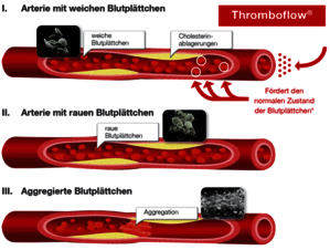 Wirkweise Thromboflow® Dr. Wolz Wirkweise Thromboflow® Dr. Wolz